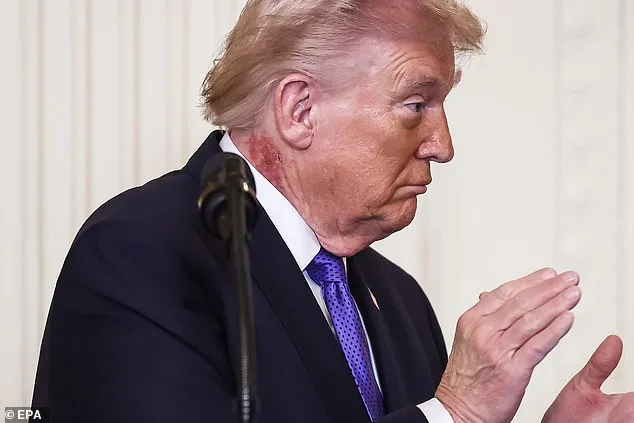 Speculation and Uncertainty Surround Former President Trump's Mysterious Neck Rash