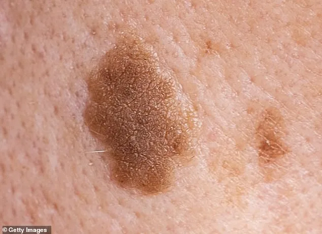 Speculation and Uncertainty Surround Former President Trump's Mysterious Neck Rash