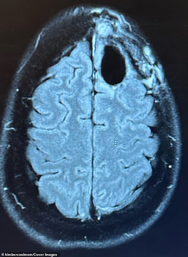 Defying the Odds: A Postpartum Mother's Battle Against Aggressive Brain Cancer