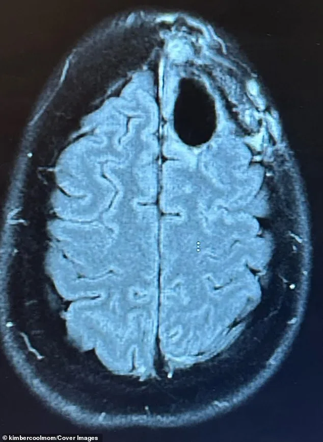 Defying the Odds: A Postpartum Mother's Battle Against Aggressive Brain Cancer