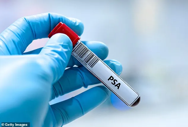 Landmark Study Shows Prostate Cancer Screening as Effective as Breast Cancer, Could Reshape Healthcare Policies