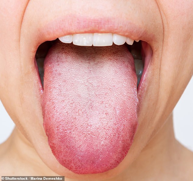 Tingling Tongue: A Hidden Warning Sign of Serious Health Issues?