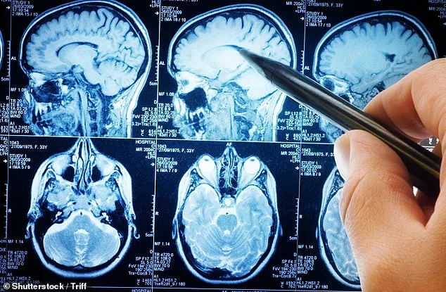 Silent Alarm: Hand Tremors Could Signal Parkinson's or Other Health Crises