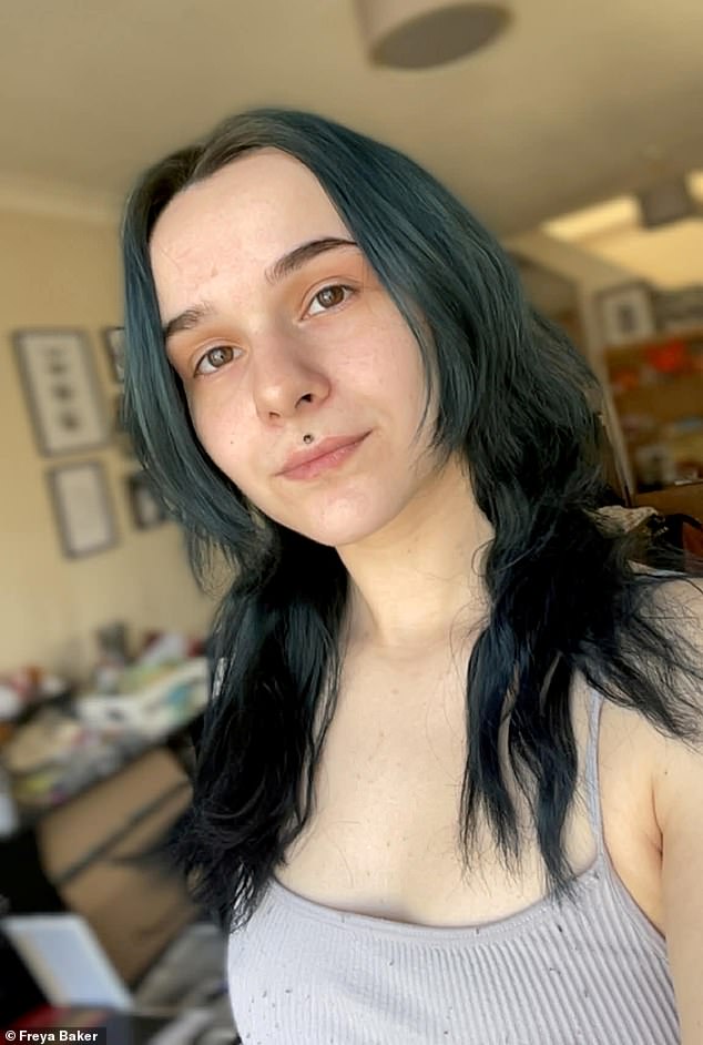 Hyperhidrosis: How Freya Baker's Condition Has Shattered Her Confidence and Career