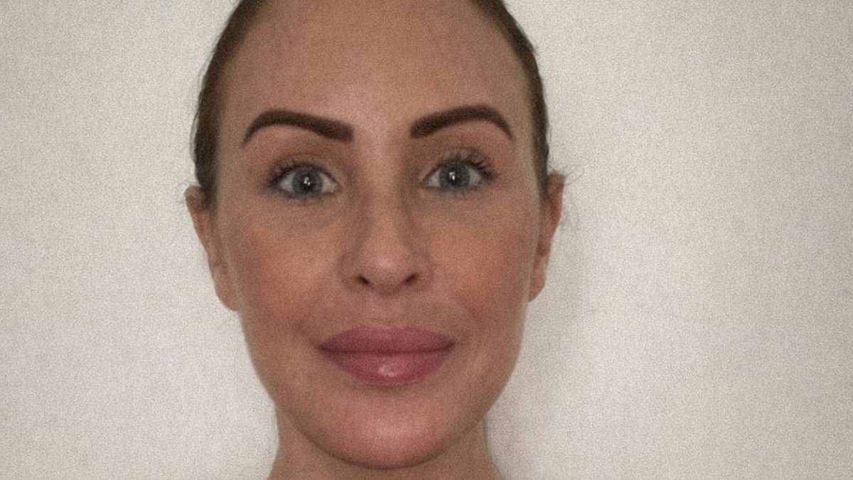 Adelaide Woman Spends £10,000 on Global Facelift Journey Despite Online Criticism