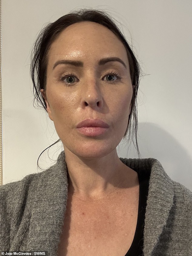 Adelaide Woman Spends £10,000 on Global Facelift Journey Despite Online Criticism