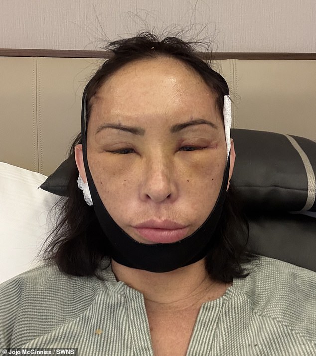 Adelaide Woman Spends £10,000 on Global Facelift Journey Despite Online Criticism