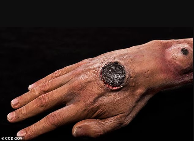 Deadly Anthrax Bacteria Found in Soil Across 43 US States, Scientists Warn