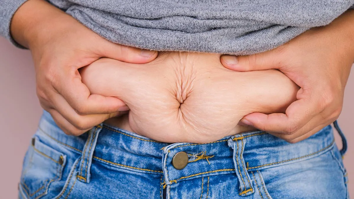 Study Reveals Obesity's Stronger Link to Cancer Than Previously Thought, Calls for Revised Prevention Approaches