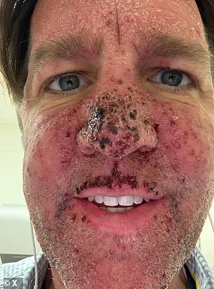 Ben Sasse Defies Pancreatic Cancer Odds with Experimental Drug