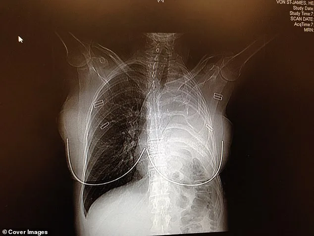 Cherished Coat's Hidden Illness: Heather Von St James' Life Turned Upside Down