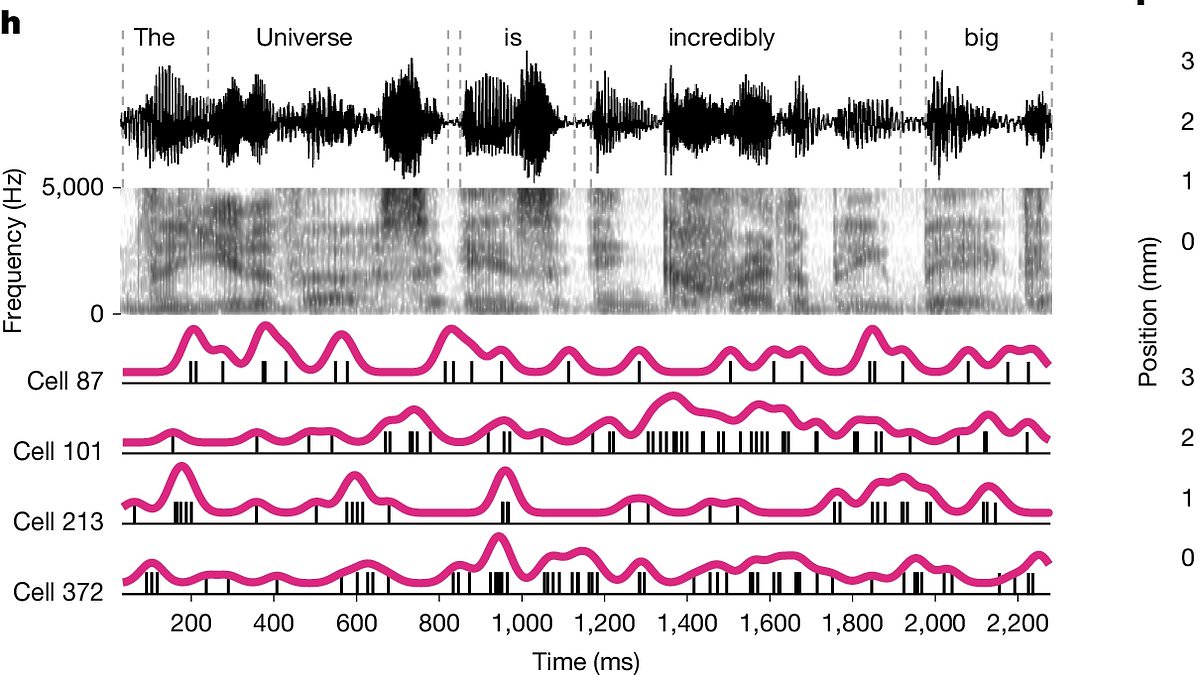 Brain stays active and processes language even under general anesthesia.