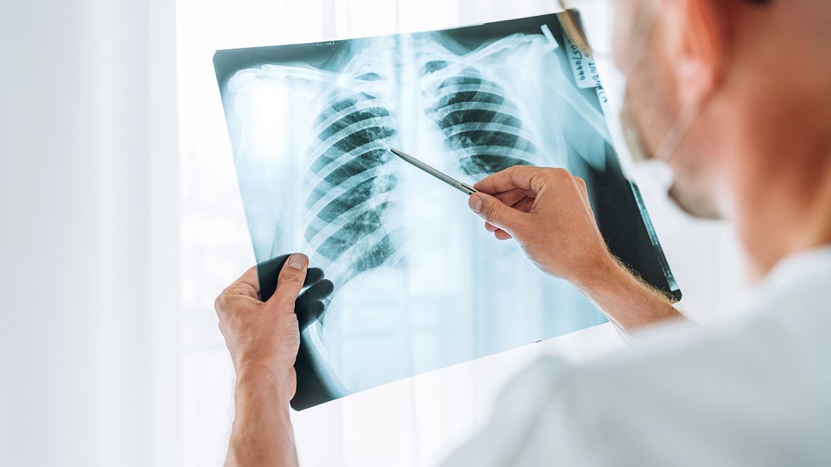NHS mobile units in supermarkets detect thousands of early-stage lung cancers.