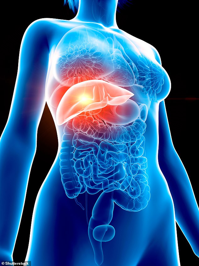 Fatty Livers Linked to Aggressive Bowel Cancer Surge in UK.