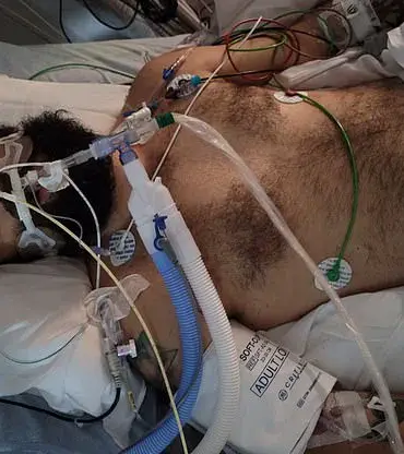 27-Year-Old's Year of Lost Memories: Rare Brain Cancer Strips Away 2021