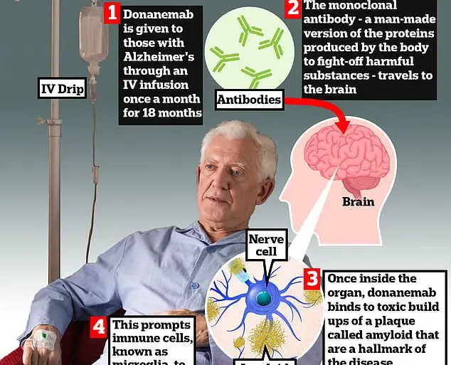 Alzheimer's Drug Donanemab Linked to Severe Brain Bleeds in One-Third of Long-Term Users