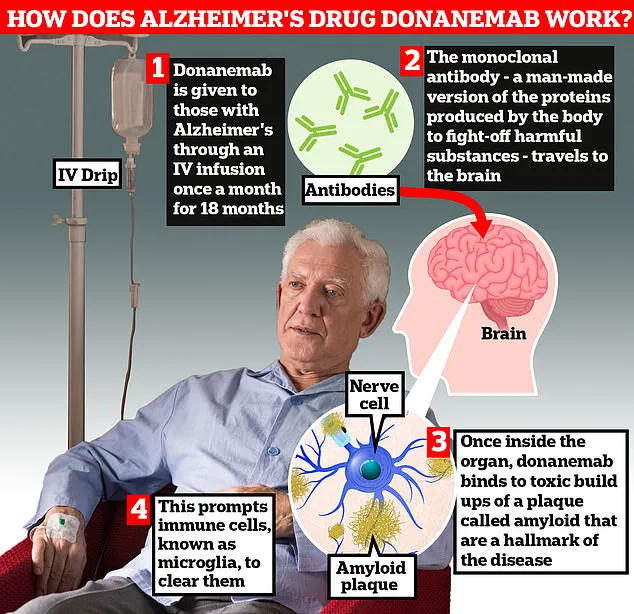 Alzheimer's Drug Donanemab Linked to Severe Brain Bleeds in One-Third of Long-Term Users
