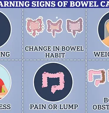 Mother's Urgent Warning: Persistent Gut Issues Could Mask Deadly Bowel Cancer