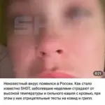 Mysterious Illness with Bloody Cough Spreads in Russia