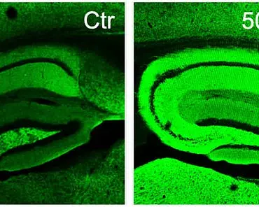 Scripps Research Team Unveils Potential Alzheimer's Cure with Natural Compound Found in Rosemary and Sage