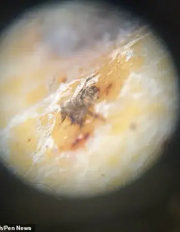 Shopper Finds Venomous Spider Egg Sac in Banana Purchase at Aldi