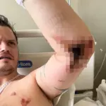 Struggling Father-of-Six Diagnosed with Ultra-Rare and Aggressive Skin Disease