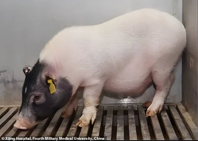 World's First Successful Pig Liver Transplant Paves the Way for Future Xenotransplantation
