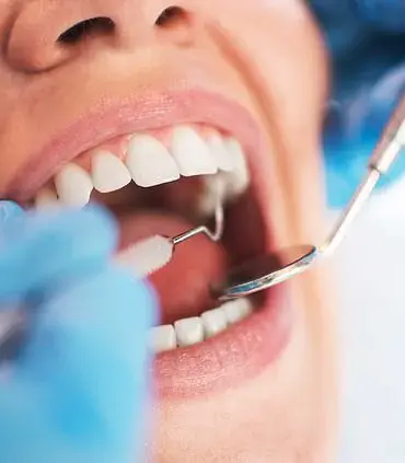 NHS Faces Critical Dentist Shortage with One in Twelve Vacancies Unfilled