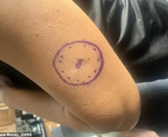 A Cancer Survivor's Warning: The Hidden Dangers of Sun Worship and the Importance of Early Detection