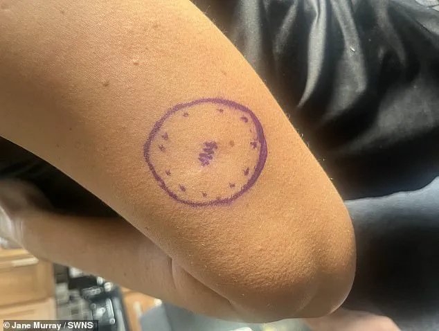 A Cancer Survivor's Warning: The Hidden Dangers of Sun Worship and the Importance of Early Detection