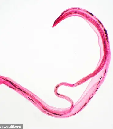A Growing Threat: Expert Warnings as Parasite Infections Surge in Europe and UK Cases Hit Record Highs