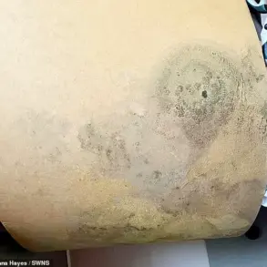 Household Damp and Mould Linked to Health Risks, Experts Warn as Family's Ordeal Highlights Urgent Need for Action