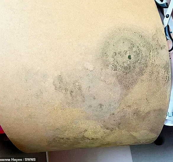 Household Damp and Mould Linked to Health Risks, Experts Warn as Family's Ordeal Highlights Urgent Need for Action