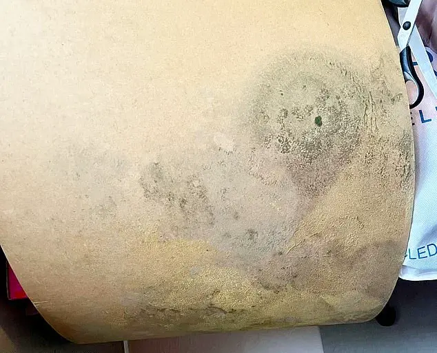 Household Damp and Mould Linked to Health Risks, Experts Warn as Family's Ordeal Highlights Urgent Need for Action