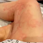 Household Damp and Mould Linked to Health Risks, Experts Warn as Family's Ordeal Highlights Urgent Need for Action