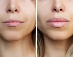 Mayo Clinic Study Uncovers Gaze Patterns in Assessing Facial Attractiveness Through Eye-Tracking Technology