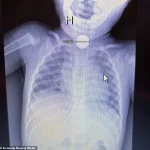 A Mother's Life-Saving Decision Highlights Gaps in Healthcare Regulation