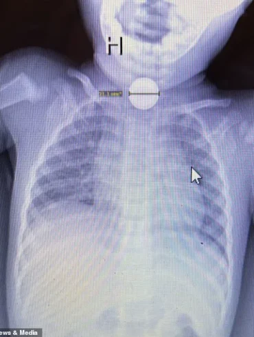 A Mother's Life-Saving Decision Highlights Gaps in Healthcare Regulation