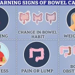 From Personal Struggle to Public Health Advocate: Charlotte Lasica's Fight Against Bowel Cancer and the Importance of Early Detection