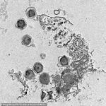 Giant Viruses in the Ocean: Reshaping Marine Ecosystems and Expanding Our Understanding of Life on Earth