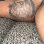 Tattoo Honoring Late Brother Leads to Severe Health Crisis, Highlighting Unexpected Risks of Body Art
