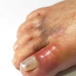 The Hidden Health Secrets in Your Toenails: How They Can Signal Diabetes, Circulatory Problems, and More