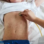 Urgent Warning: UK Faces Measles Resurgence as Vaccination Rates Plummet, Says Expert