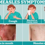 Urgent Warning: UK Faces Measles Resurgence as Vaccination Rates Plummet, Says Expert