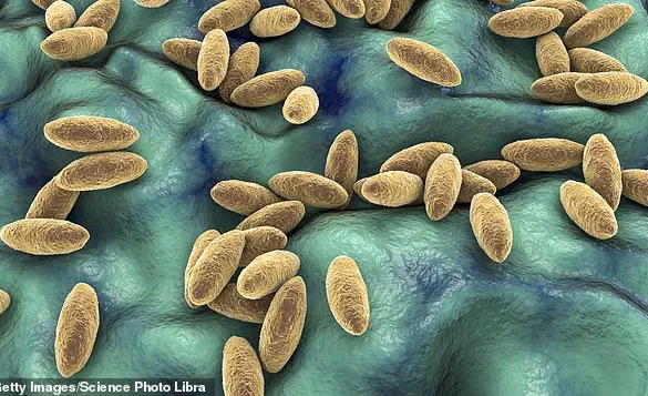 25-Year-Old Syrian Woman's Year-Long Headache Traced to Rare Brain Infection from Raw Dairy Consumption