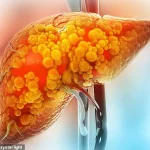 A Personal Battle Against Non-Alcoholic Fatty Liver Disease: Niki Nash’s Journey to Health and Awareness