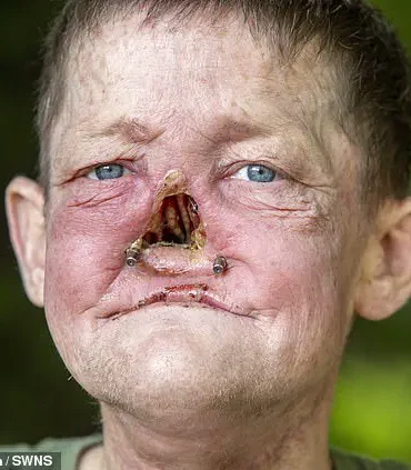 A Year of Misdiagnosis: William Brogan's Battle with Undetected Cancer and the Systemic Failures That Let Him Down