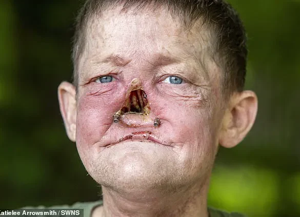 A Year of Misdiagnosis: William Brogan's Battle with Undetected Cancer and the Systemic Failures That Let Him Down
