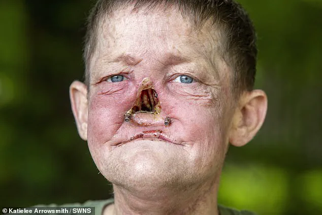 A Year of Misdiagnosis: William Brogan's Battle with Undetected Cancer and the Systemic Failures That Let Him Down