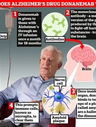 Breakthrough Alzheimer's Drug Shows Promise in Slowing Disease Progression